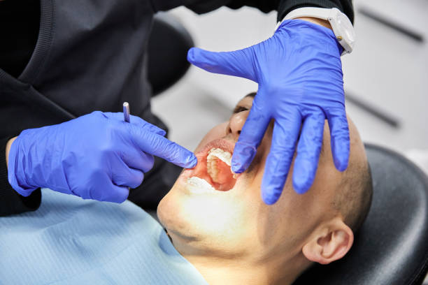 Best Broken or Chipped Tooth Repair in Beaufort, NC